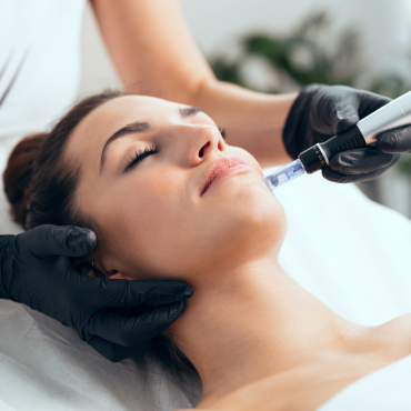 Microdermabrasion Treatment